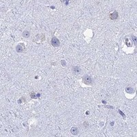 HPA IHC Cerebral cortex — ALMS1