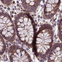 HPA IHC Colon — PPP2CB