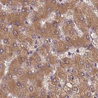 HPA IHC Liver — PPP2CB