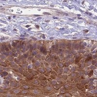 HPA IHC Esophagus — PPP2CB