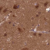 HPA IHC Cerebral cortex — PPP2CB