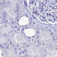 HPA IHC Kidney — HSPA1L