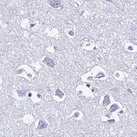 HPA IHC Cerebral cortex — HSPA1L