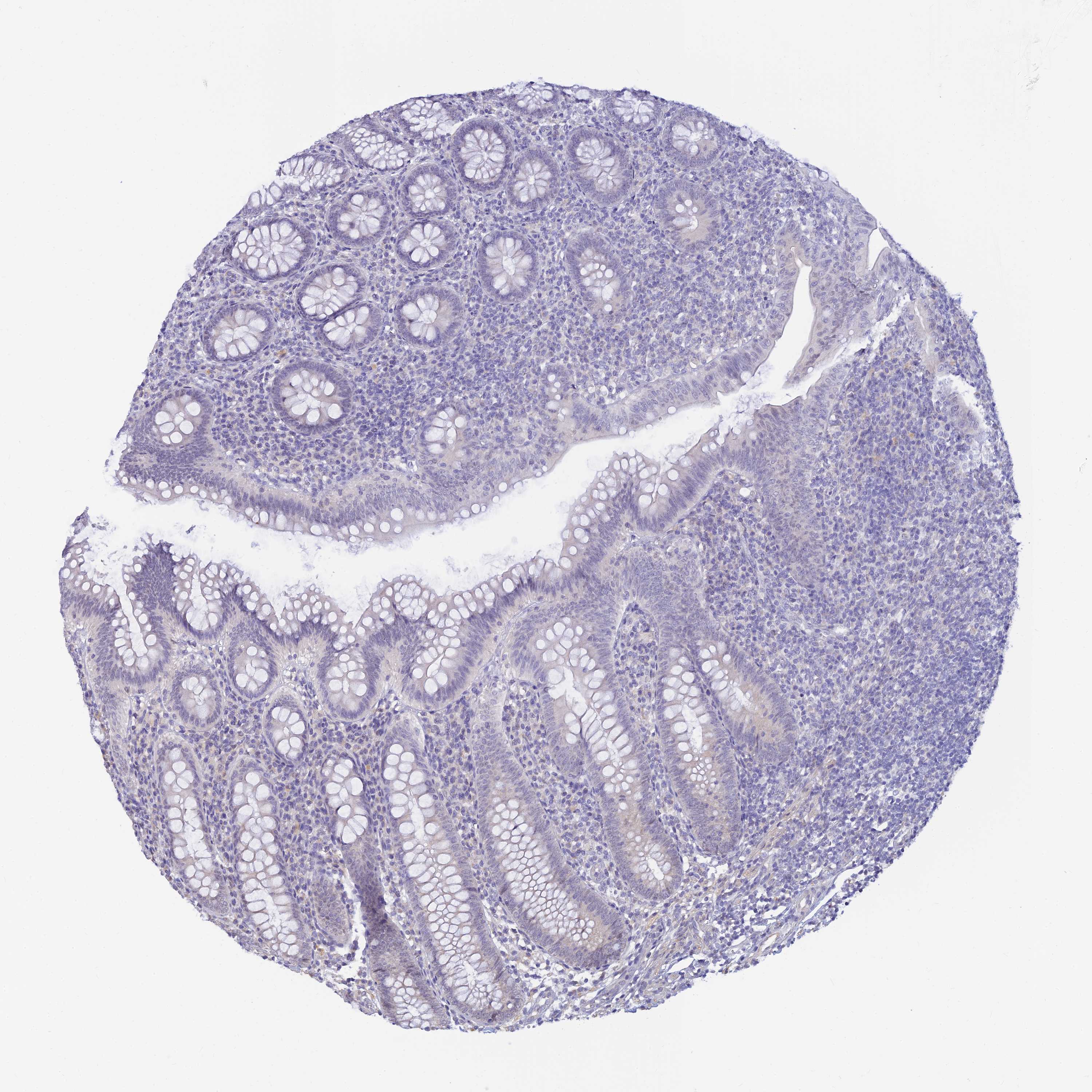 Tissue expression of UPK2 Staining in appendix The Human Protein Atlas