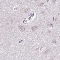 HPA IHC Cerebral cortex — SREBF1