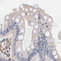 HPA IHC Colon — IFITM2