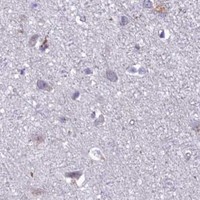 HPA IHC Cerebral cortex — RANBP3
