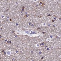 HPA IHC Cerebral cortex — KDELR3