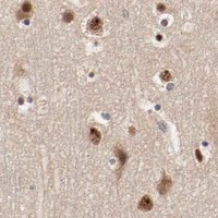 HPA IHC Cerebral cortex — CSNK2B