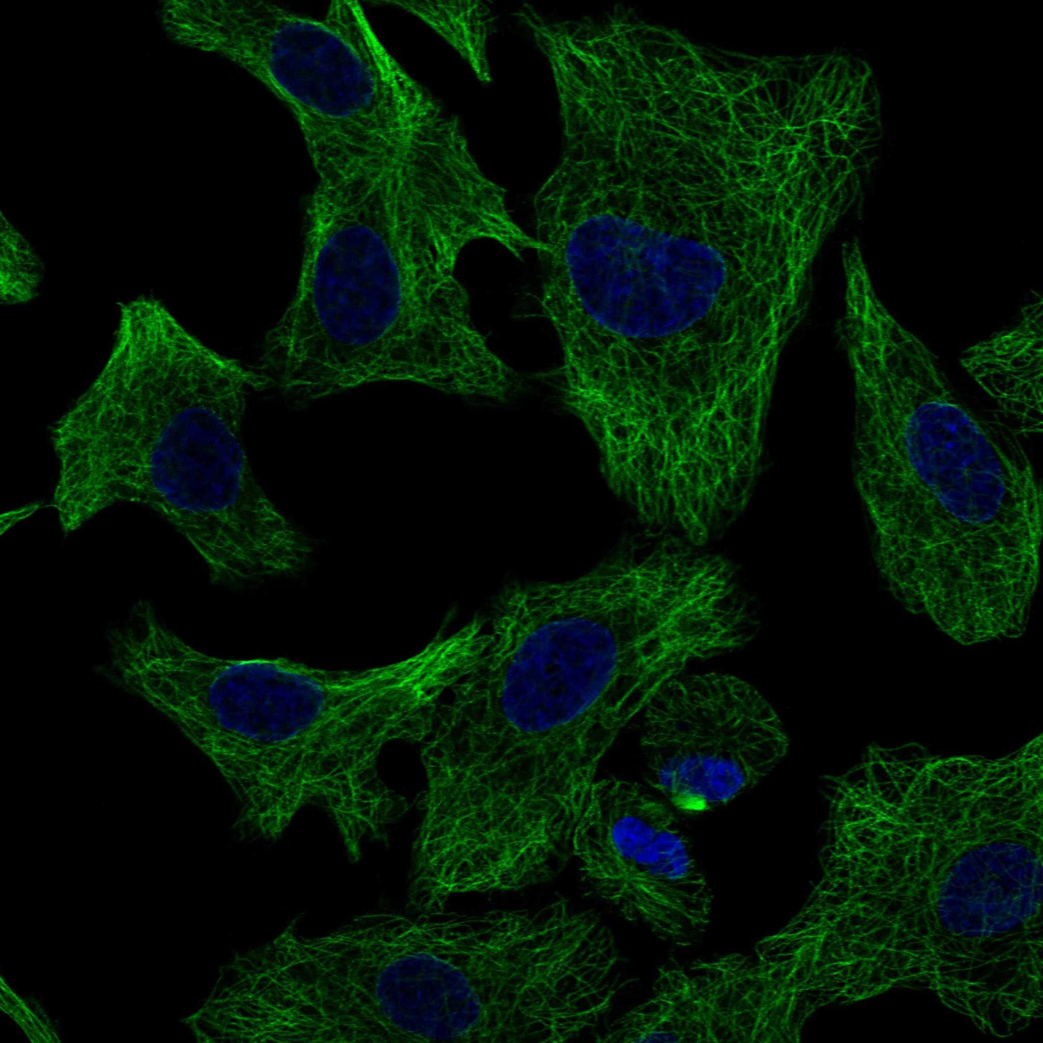 Subcellular TUBB3 The Human Protein Atlas