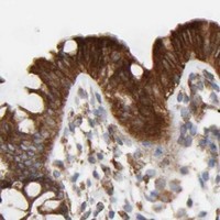 HPA IHC Colon — POR
