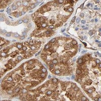 HPA IHC Kidney — POR
