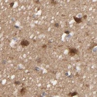 HPA IHC Cerebral cortex — POR