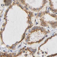 HPA IHC Thyroid gland — DOCK1