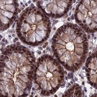 HPA IHC Colon — TCEA1