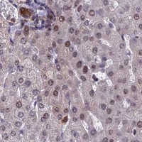 HPA IHC Liver — TCEA1