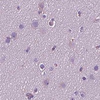 HPA IHC Cerebral cortex — PTPRC