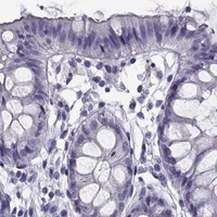 HPA IHC Colon — CABS1