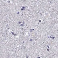 HPA IHC Cerebral cortex — CABS1