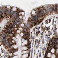 HPA IHC Colon — ACAT1