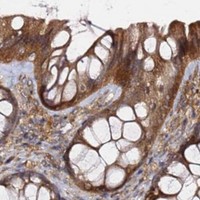 HPA IHC Colon — PRKAB2