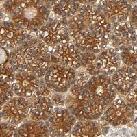 HPA IHC Parathyroid gland — IKBKB