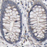 HPA IHC Colon — IKBKB
