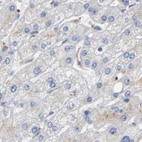 HPA IHC Liver — IKBKB
