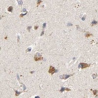 HPA IHC Cerebral cortex — IKBKB