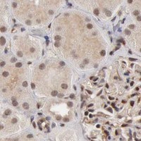 HPA IHC Kidney — CDKN2A