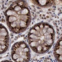 HPA IHC Colon — CDKN2A