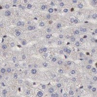 HPA IHC Liver — CDKN2A