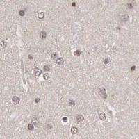 HPA IHC Cerebral cortex — CDKN2A