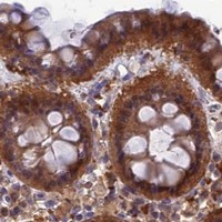 HPA IHC Colon — HINT1
