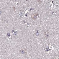 HPA IHC Cerebral cortex — CDNF