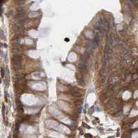HPA IHC Colon — IRAK1