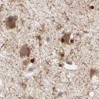 HPA IHC Cerebral cortex — IRAK1