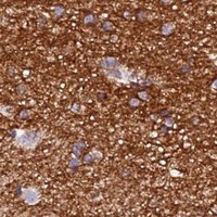 HPA IHC Cerebral cortex — GPD1