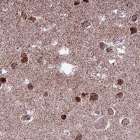 HPA IHC Cerebral cortex — CERS6