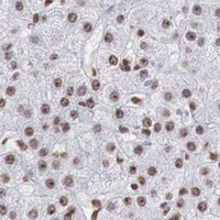 HPA IHC Liver — DKC1