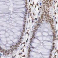 HPA IHC Colon — DKC1