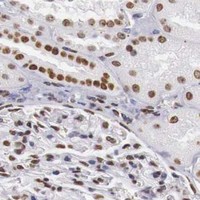 HPA IHC Kidney — DKC1