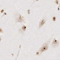 HPA IHC Cerebral cortex — DKC1