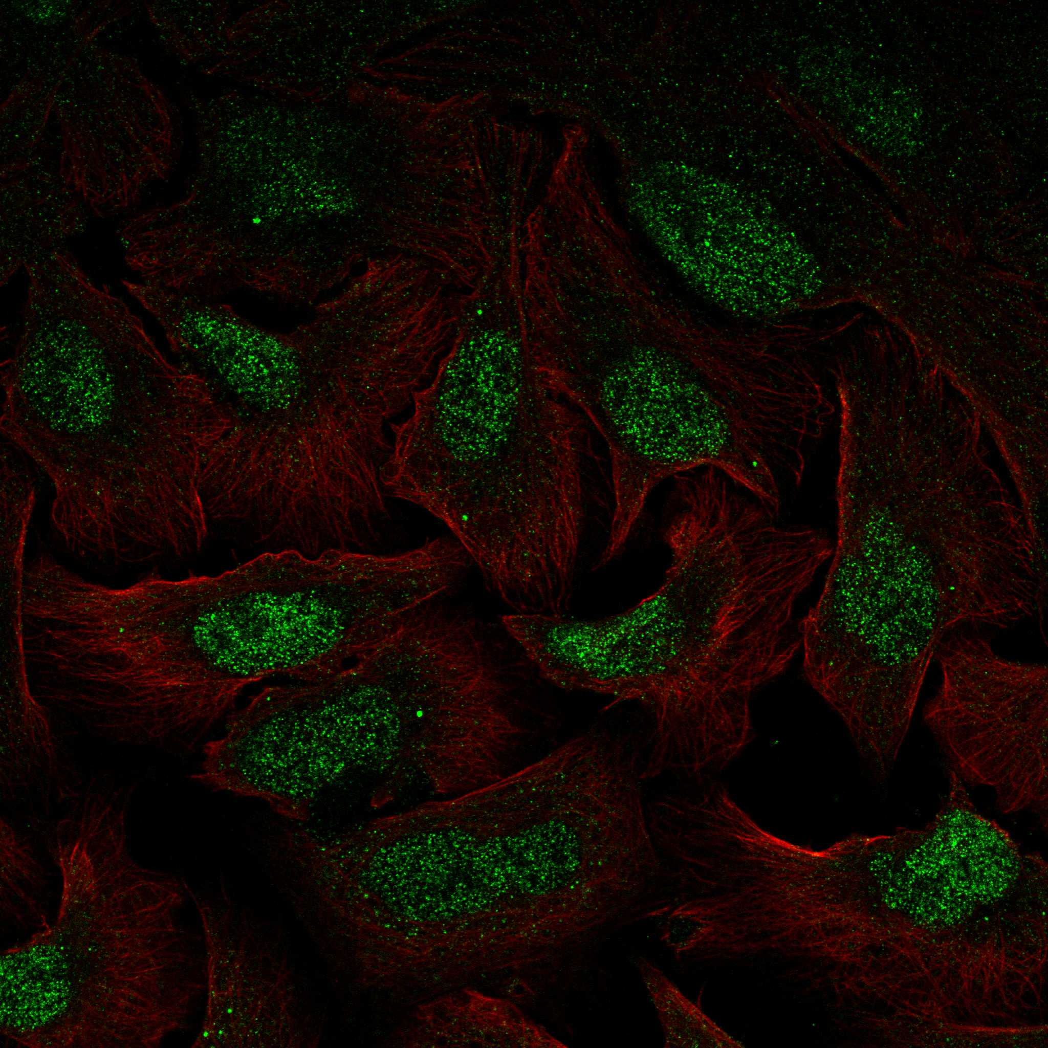 Cell atlas CDK8 The Human Protein Atlas
