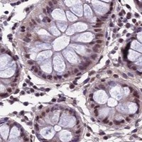 HPA IHC Colon — RSRC1