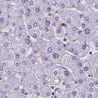 HPA IHC Liver — RSRC1