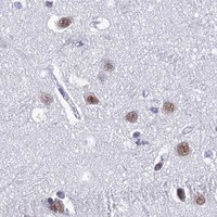 HPA IHC Cerebral cortex — RSRC1