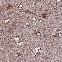 HPA IHC Cerebral cortex — GLUD2