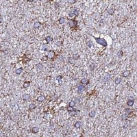 HPA IHC Cerebral cortex — GLUD1