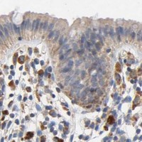 HPA IHC Colon — NDUFS3